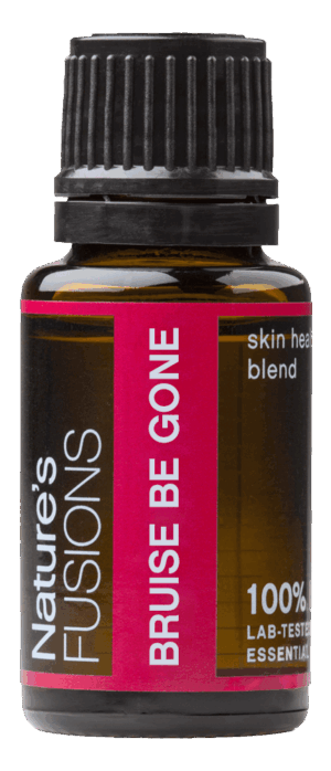 Bruise Be Gone (Soothing) Essential Oil Blend